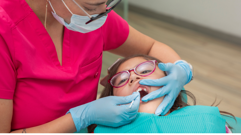 Silver Diamine Fluoride (SDF): A Revolutionary Approach to Cavity Treatment