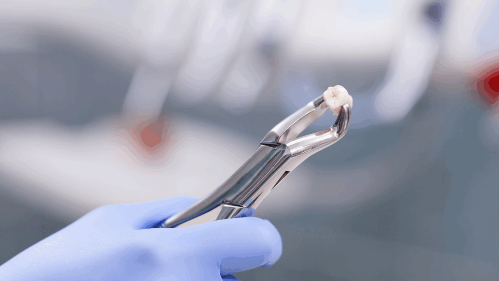 Tooth Extraction: What to Expect and Replacement Options