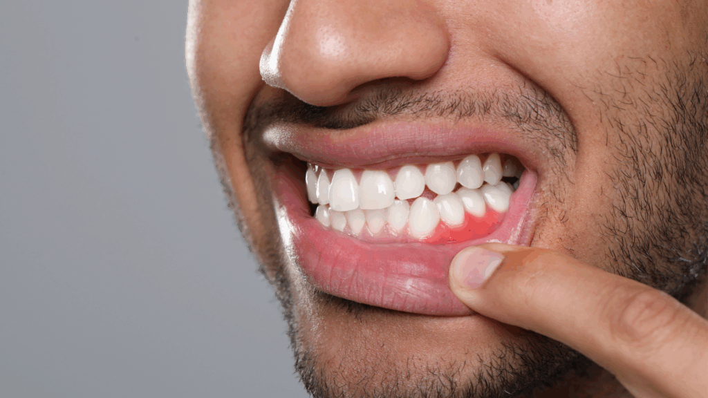 How to Keep Healthy Gums and Teeth