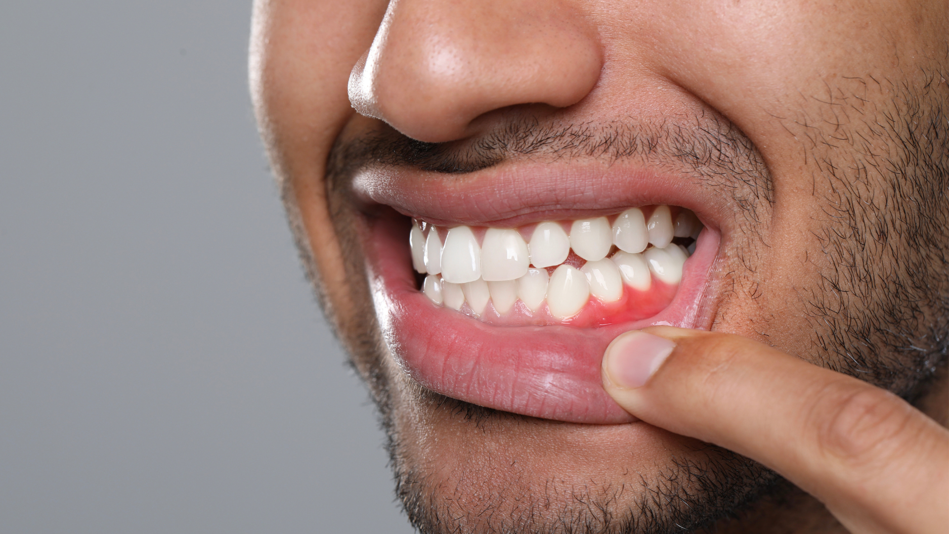 How to Keep Healthy Gums and Teeth